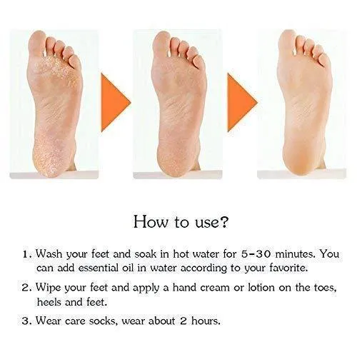 Anti-Crack Silicone Gel Foot Moisturizing Socks