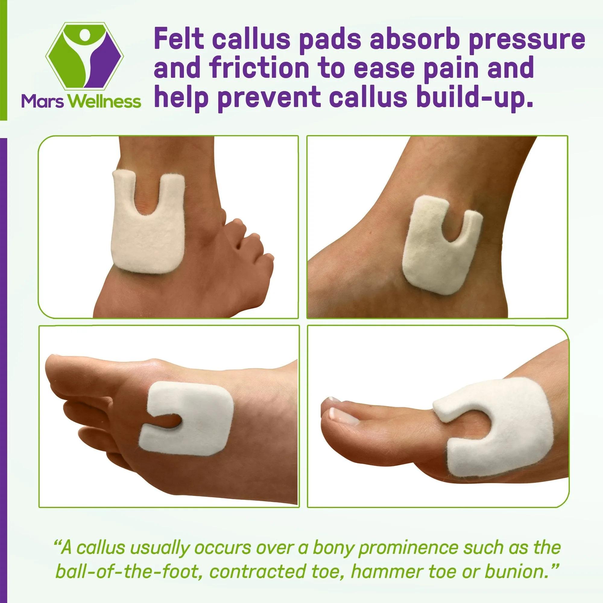 Wide U Shaped Felt Callus Horseshoe Pads - Adhesive Foot Pads That Protect Calluses from Rubbing On Shoes - 1/8"
